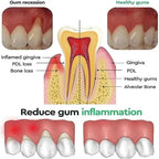 Gum Repair Care Gel Relieve Sore Gum Improve Gingival Damaged Inflammation Cleaning Teeth Stains Tartar Whitener Gum Protect Gel