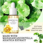 Centella Asiatica Brightening Serum: Calms Irritation, Reduces Breakouts, Balances Sebum & Diminishes Dark Marks for Clear Skin.