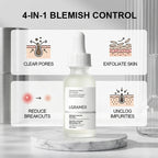 2% Salicylic Acid Facial Serum, Anti-Acne Essence for Troubled Skin, Deep Hydrating & Pore Cleansing Daily Facial Skin Care