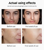 20% Vitamin C Ampoule Serum Set  Moisturising Whitening Wrinkle Reducing Anti-Ageing Serum Face Beauty Skin Care