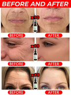 wrinkles disappear become beautiful now