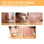 Glycolic Acid 7% Toning Solution Ordinary Acne Remover Lifting Firming Wrinkles Glowing Facial Skin Care Glycolic Acid Toner