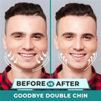 U Shape Jaw Exerciser New Facial Mouth Jawline Face Fitness Muscle Chew Ball Bite Breaker Training Equipment