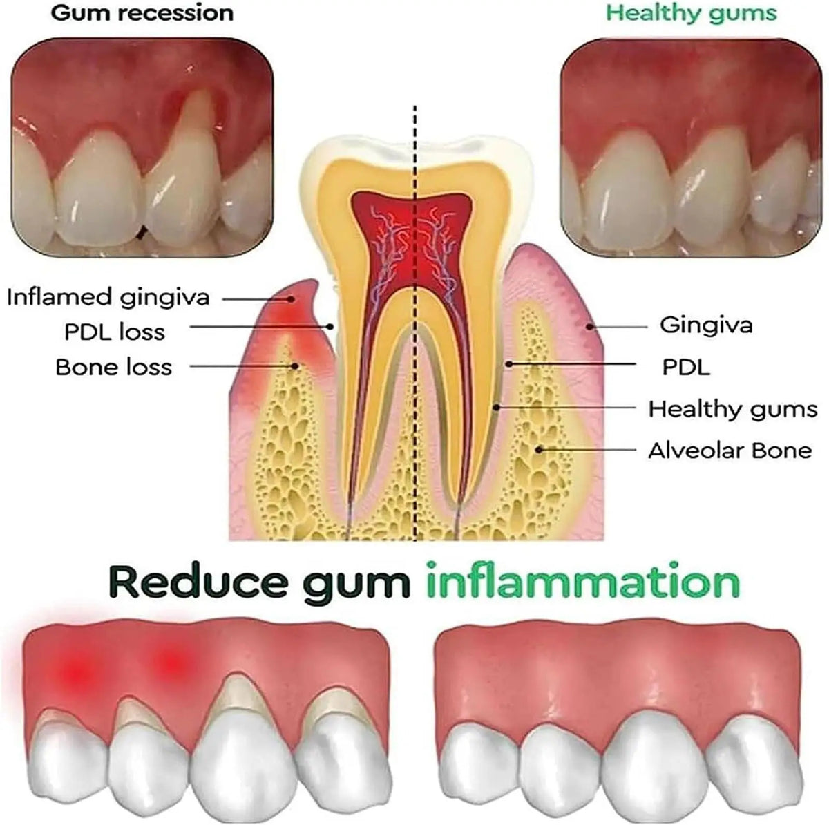 50ML Damaged Gum RepairCare Gel Serum Relieve Sore Gums Allergy Deep Cleaning Teeth Stains Tartar Serum Dental Caries Toothpaste