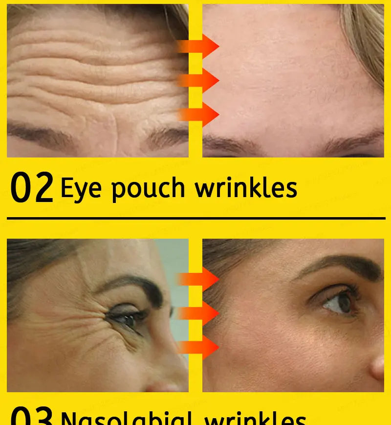 wrinkles disappear become beautiful now