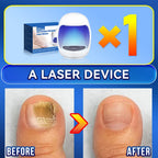 2025 Hot selling Generation-2，Rejuvenator - Fungus Prevention Technology - Adjustable Control & Safety Sensor,unisex
